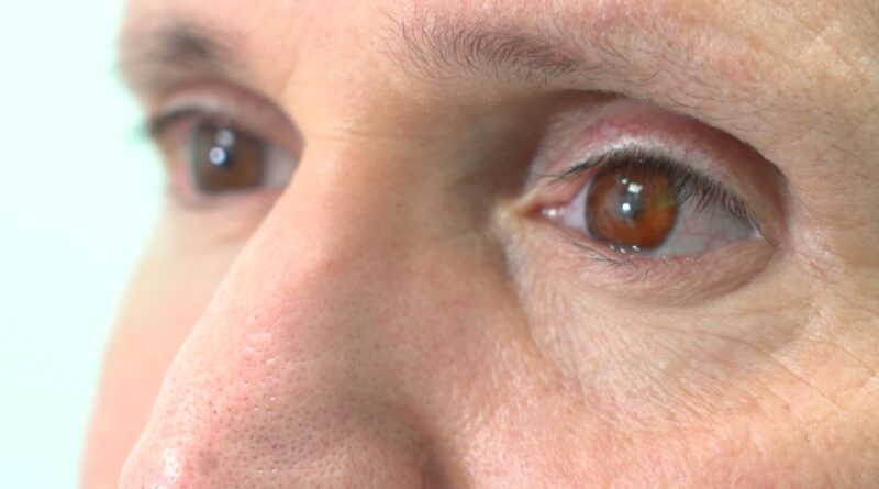 Man Given First Ever 3D Printed Eye, Hospital Says