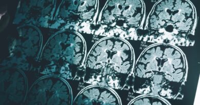 Single Brain Scan Can Diagnose Alzheimer’s Disease