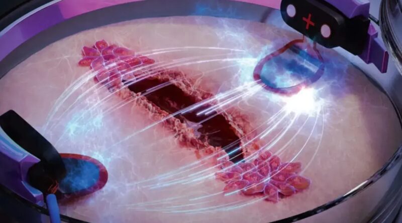 electricity wound healing
