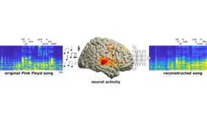 Neuroscientists Decode Song From Brain Recordings