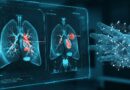 New AI Detects 97% of Lung Diseases, Can Tell Pneumonia from COVID