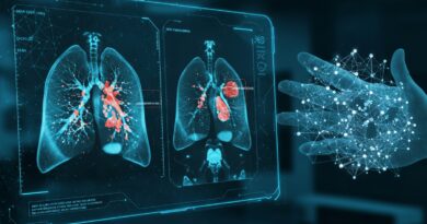 New AI Detects 97% of Lung Diseases, Can Tell Pneumonia from COVID